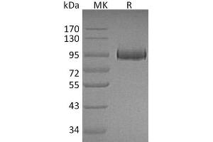 Western Blotting (WB) image for Myeloperoxidase (MPO) protein (His tag) (ABIN7320799) (Myeloperoxidase Protein (MPO) (His tag))