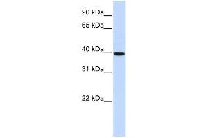 WB Suggested Anti-HOXB3 Antibody Titration: 0. (HOXB3 antibody  (N-Term))