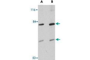 Western blot analysis of TMC8 in Jurkat cell lysate with TMC8 polyclonal antibody  at (A) 1 and (B) 2 ug/mL . (TMC8 antibody  (Internal Region))