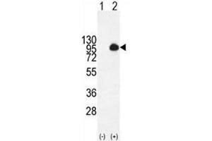Western blot analysis of MUC20 antibody and 293 cell lysate (2 ug/lane) either nontransfected (Lane 1) or transiently transfected with the MUC20 gene (2). (MUC20 antibody  (AA 61-90))