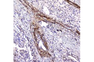 IHC analysis of Serum Amyloid P using anti-Serum Amyloid P antibody . (APCS antibody  (AA 20-220))