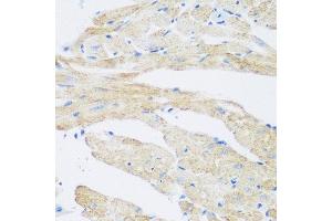 Immunohistochemistry of paraffin-embedded mouse heart using NAT8B antibody at dilution of 1:200 (40x lens).
