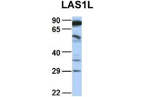 Host:  Rabbit  Target Name:  LAS1L  Sample Type:  COLO205  Antibody Dilution:  1.