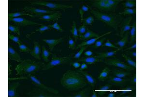Immunofluorescence of monoclonal antibody to IGDCC4 on HeLa cell. (IGDCC4 antibody  (AA 1152-1250))