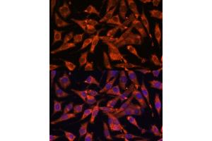 Immunofluorescence analysis of L929 cells using MT-ND1 Polyclonal Antibody (ABIN7268598) at dilution of 1:100 (40x lens). (MT-ND1 antibody)