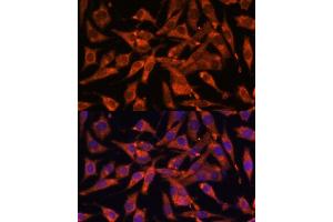 Immunofluorescence analysis of L929 cells using MT-ND1 Polyclonal Antibody (ABIN7268598) at dilution of 1:100 (40x lens). (MT-ND1 antibody)