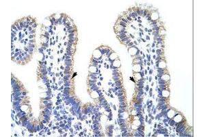 Image no. 1 for anti-Exosome Component 10 (EXOSC10) (C-Term) antibody (ABIN203030) (EXOSC10 antibody  (C-Term))