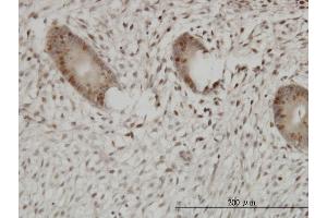 Immunostaining (ISt) image for anti-Ubiquitin-Like, Containing PHD and RING Finger Domains, 1 (UHRF1) (AA 694-793) antibody (ABIN565416)