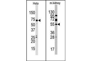 Image no. 1 for anti-Jumonji Domain Containing 4 (JMJD4) (C-Term) antibody (ABIN356562) (JMJD4 antibody  (C-Term))