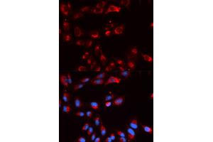 Immunofluorescence analysis of U2OS cells using CFP antibody (ABIN5973127). (CFP antibody)