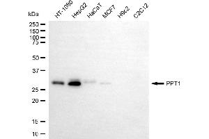 Western blotting analysis using PPT1 antibody (ABIN7799730). (PPT1 antibody)