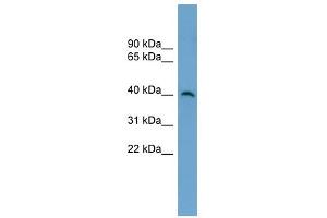 SUV39H2 antibody used at 1 ug/ml to detect target protein. (SUV39H2 antibody)