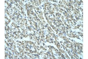 Rabbit Anti-FGD1 Antibody Catalog Number: ARP31673  Paraffin Embedded Tissue: Human cardiac cell  Cellular Data: Epithelial cells of renal tubule Antibody Concentration:  4.