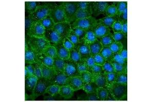 IF analysis of P cadherin using anti-P cadherin antibody (ABIN7599888).