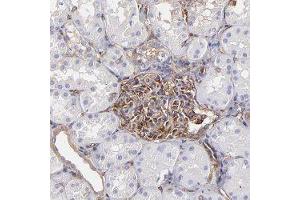 Immunohistochemical staining of human kidney with MYH9 polyclonal antibody  shows distinct cytoplasmic positivity in cells in glomeruli.