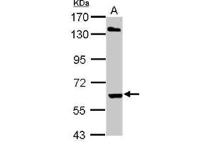 WB Image Sample (30 ug of whole cell lysate) A: Hela 7. (ARIH2 antibody  (C-Term))