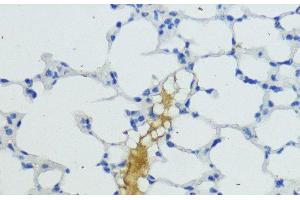Immunohistochemistry of paraffin-embedded Mouse lung using KLKB1 Polyclonal Antibody at dilution of 1:200 (40x lens). (KLKB1 antibody)