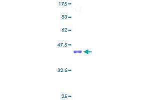 SCP2 Protein (AA 1-143) (GST tag)