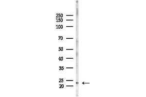 anti-Chp2 (Internal Region) antibody
