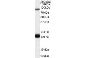 Western Blotting (WB) image for anti-RAS Protein Activator Like 1 (GAP1 Like) (RASAL1) (C-Term) antibody (ABIN2466182)