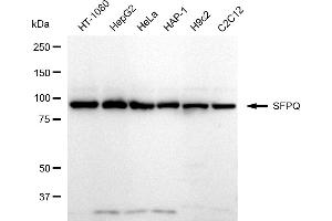 Western blotting analysis using SFPQ antibody (ABIN7800427). (Recombinant SFPQ antibody)