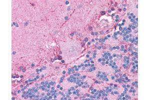 Anti-CLIC6 antibody IHC of human brain, cerebellum. (CLIC6 antibody  (AA 435-484))