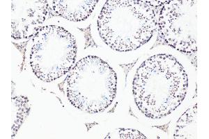 Immunohistochemistry of paraffin-embedded Mouse testis using Bcl9 antibody (ABIN6129972, ABIN6137514, ABIN6137515 and ABIN6222543) at dilution of 1:100 (20x lens). (BCL9 antibody)