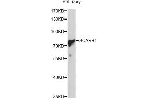 Western blot analysis of extracts of rat ovary, using SCARB1 Antibody (ABIN5970764) at 1/1000 dilution.