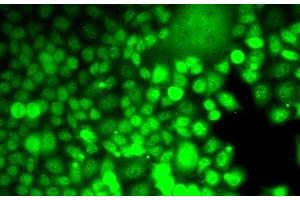 Immunofluorescence analysis of MCF7 cells using ALOX15B Polyclonal Antibody (ALOX15B antibody)