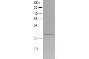 Western Blotting (WB) image for Poly(rC) Binding Protein 1 (PCBP1) (AA 1-163) protein (His tag) (ABIN7287278) (PCBP1 Protein (AA 1-163) (His tag))