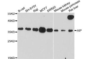 Western blot analysis of extracts of various cell lines, using AIP antibody. (AIP antibody)