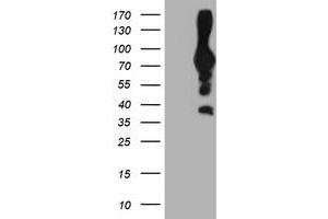 Western Blotting (WB) image for anti-phosphofructokinase, Platelet (PFKP) antibody (ABIN1500163) (PFKP antibody)
