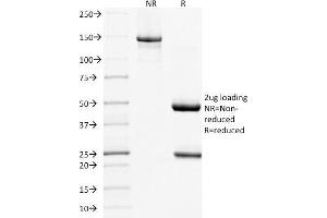 SDS-PAGE Analysis Purified MUC16 Mouse Monoclonal Antibody (MUC16/1860). (MUC16 antibody)