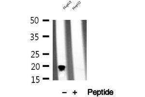 Western blot analysis of extracts of HepG2 cells, using NDUFB11 antibody. (NDUFB11 antibody  (N-Term))