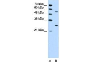 Western Blotting (WB) image for anti-3-phosphoinositide Dependent Protein Kinase-1 (PDPK1) antibody (ABIN2460187) (PDPK1 antibody)