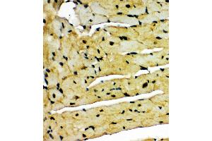 Anti-Aryl hydrocarbon Receptor antibody,  IHC(P) IHC(P): Mouse Cardiac Muscle Tissue