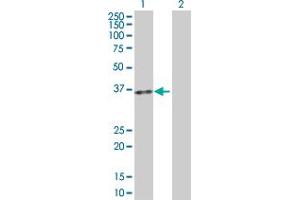 Western Blot analysis of ACP5 expression in transfected 293T cell line by ACP5 MaxPab polyclonal antibody. (ACP5 antibody  (AA 1-325))