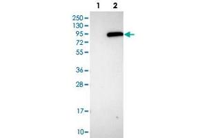 Western blot analysis of HEK293T cell lysate using PLA2G6 polyclonal antibody . (PLA2G6 antibody)