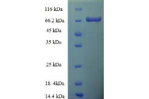 SDS-PAGE (SDS) image for Tetrahydrobiopterin (BH4) (AA 1-461), (full length) protein (His-SUMO Tag) (ABIN5710494)