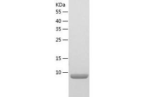 Western Blotting (WB) image for Apolipoprotein C-II (APOC2) (AA 23-101) protein (His tag) (ABIN7121869) (Apolipoprotein C-II Protein (APOC2) (AA 23-101) (His tag))