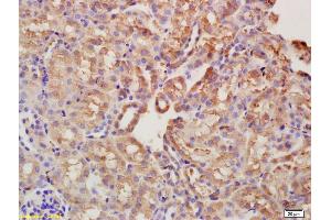 Formalin-fixed and paraffin embedded mouse kidney labeled with Anti-CYP4A1 Polyclonal Antibody, Unconjugated (ABIN708986) at 1:200 followed by conjugation to the secondary antibody and DAB staining (CYP4A11 antibody  (AA 351-450))