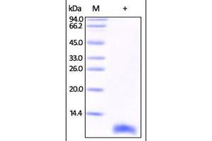 Human S100B, His Tag on SDS-PAGE under reducing (R) condition. (S100B Protein (AA 2-92) (His tag))