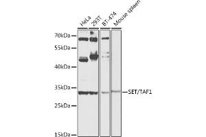 Western blot analysis of extracts of various cell lines, using SET/T antibody (ABIN6131352, ABIN6147630, ABIN6147633 and ABIN6216166) at 1:1000 dilution. (SET/TAF-I antibody  (AA 146-277))