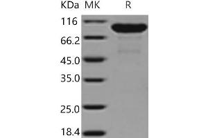 Western Blotting (WB) image for Matrix Metallopeptidase 9 (Gelatinase B, 92kDa Gelatinase, 92kDa Type IV Collagenase) (MMP9) (Active) protein (His tag) (ABIN7196958) (MMP 9 Protein (His tag))