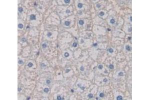 IHC-P analysis of Human Tissue, with DAB staining. (S100A12 antibody  (AA 1-92))