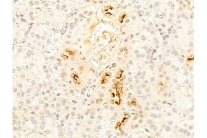 ABIN6258067 and ABIN6274651 at 1/100 staining Mouse kidney tissue by IHC-P.