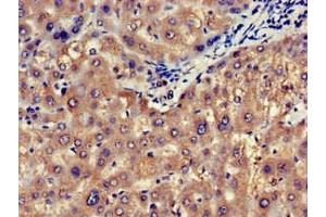 Immunohistochemistry of paraffin-embedded human liver tissue using ABIN7146747 at dilution of 1:100
