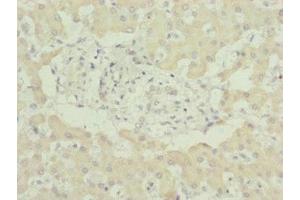 Immunohistochemistry of paraffin-embedded human liver tissue using ABIN7174236 at dilution of 1:100 (MNF1 antibody  (AA 14-126))