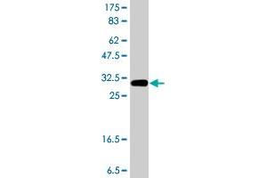 Western Blot detection against Immunogen (37. (RASSF5 antibody  (AA 100-206))