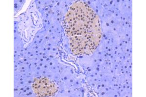 Paraformaldehyde-fixed, paraffin embedded Mouse pancreas, Antigen retrieval by boiling in sodium citrate buffer (pH6) for 15min, Block endogenous peroxidase by 3% hydrogen peroxide for 30 minutes, Blocking buffer at 37°C for 20min, Antibody incubation with HDAC1 (3C3) Monoclonal Antibody  at 1:50 overnight at 4°C, followed by a conjugated secondary and DAB staining. (HDAC1 antibody)